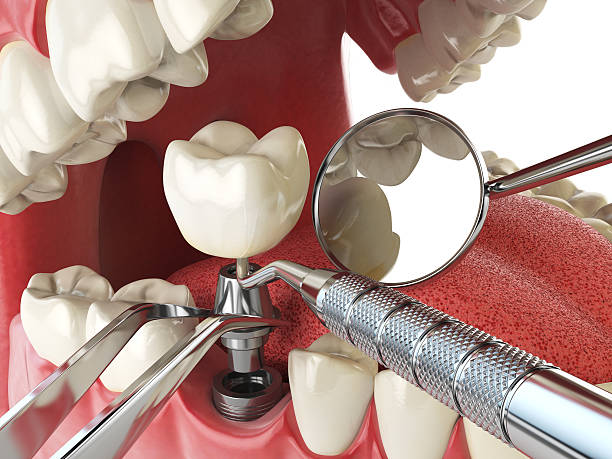 Best Weekend Emergency Dental Services in Sullivan, IL