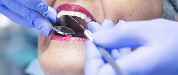 Best Emergency Care for Gum Disease in Sullivan, IL